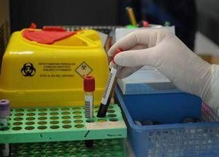 Tumori, nuovo test del sangue 'low cost' promette di scoprire diversi tipi di cancro