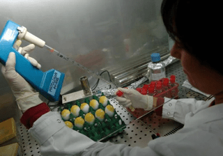 Lupus eritematoso, Moroni (San Raffaele): "Priorità approccio multidisciplinare"