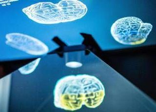 Ictus, ecco come l'emisfero sano del cervello influenza la ripresa: la ricerca rivoluzionaria
