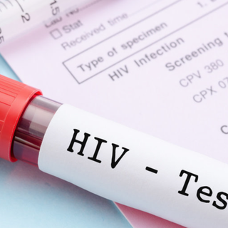 Giornata mondiale Hiv: nel 2023 a Vercelli 14 casi nuovi e 4 decessi