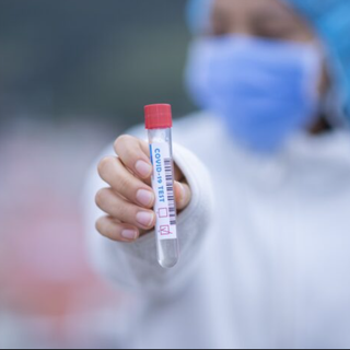 Il virus nel vercellese: 28 contagi e 24 persone guarite. Nessun morto nelle ultime 24 ore