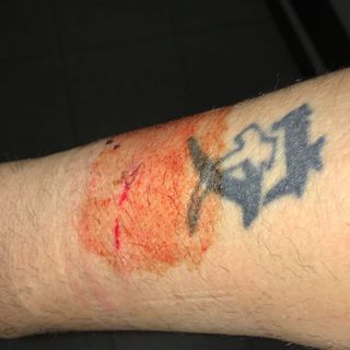 Il braccio del giovane