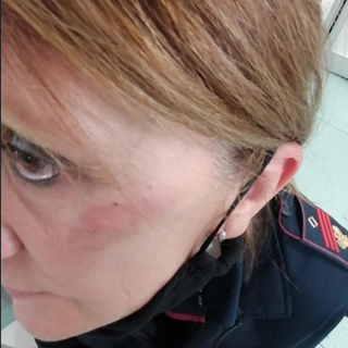 «Calci in faccia alla collega della Volante: violenza intollerabile verso chi fa il proprio dovere»