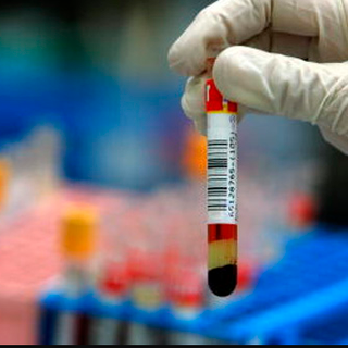 Il precedente: tre persone malate, 30 infette, e più di 250 controlli