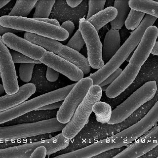 E. Coli Bacteria - Credit: NIAID