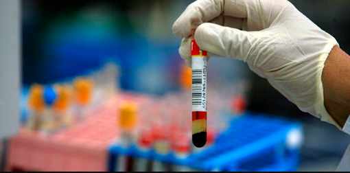 Il precedente: tre persone malate, 30 infette, e più di 250 controlli Il precedente: tre persone malate, 30 infette, e più di 250 controlli