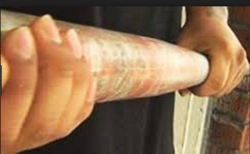 La lite in macelleria finisce a bastonate: un ferito La lite in macelleria finisce a bastonate: un ferito