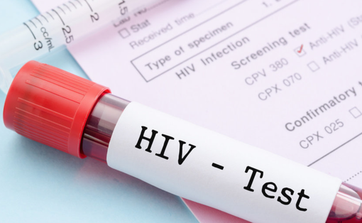 Giornata mondiale Hiv: nel 2023 a Vercelli 14 casi nuovi e 4 decessi Giornata mondiale Hiv: nel 2023 a Vercelli 14 casi nuovi e 4 decessi