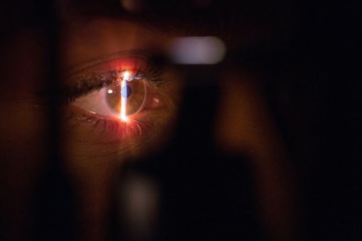 Laser occhi miopia: come cambia la stabilità della visione nel tempo dopo l’intervento