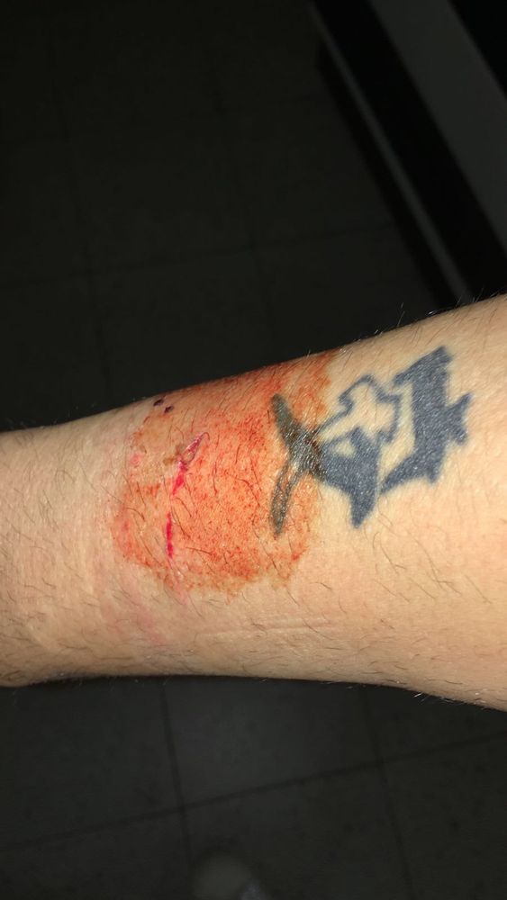 Il braccio del giovane Il braccio del giovane