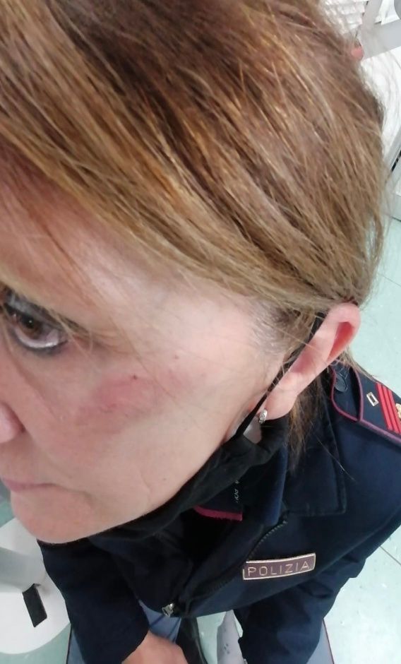 La poliziotta colpita nel corso dell'intervento