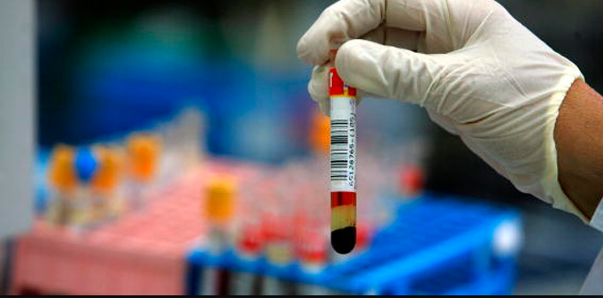 Il precedente: tre persone malate, 30 infette, e più di 250 controlli