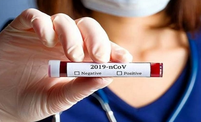 Ancora un morto nel bollettino covid: sono 516 da inizio pandemia Ancora un morto nel bollettino covid: sono 516 da inizio pandemia