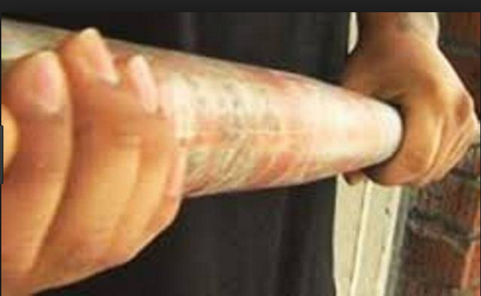 La lite in macelleria finisce a bastonate: un ferito La lite in macelleria finisce a bastonate: un ferito