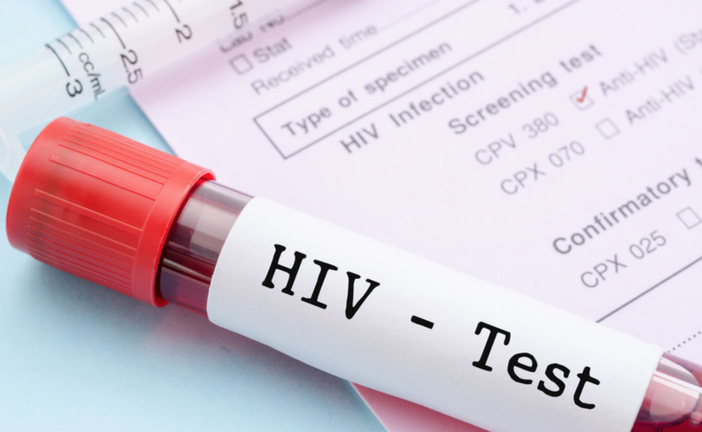 Giornata mondiale Hiv: nel 2023 a Vercelli 14 casi nuovi e 4 decessi