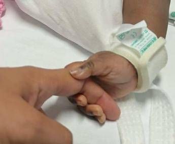 Gemelle siamesi separate al Gaslini di Genova: "Estubate, respirano da sole"