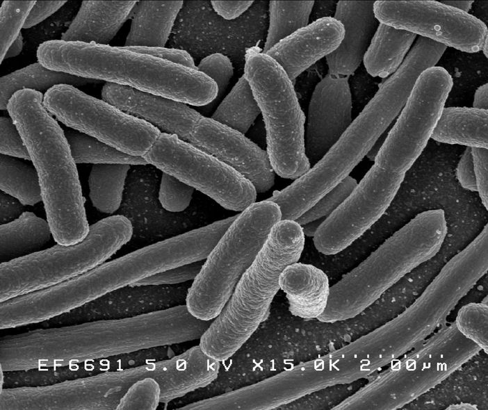 E. Coli Bacteria - Credit: NIAID