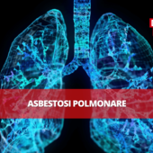 Ali di amianto: il TAR del Lazio condanna il Ministero della Difesa al risarcimento, per asbestosi