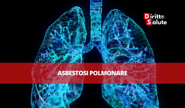 Amianto e Marina Militare: condanna per il Ministero della Difesa, riconosciuto lo status di "vittima del dovere" ad ex Maresciallo Amianto e Marina Militare: condanna per il Ministero della Difesa, riconosciuto lo status di "vittima del dovere" ad ex Maresciallo