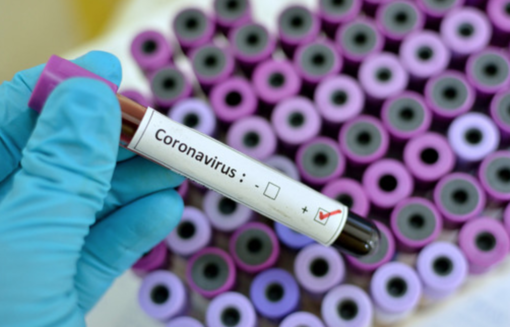 Il virus nel vercellese: 15 casi nuovi, 11 guariti