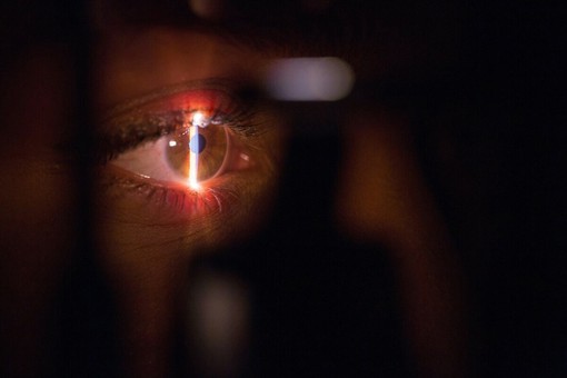 Laser occhi miopia: come cambia la stabilità della visione nel tempo dopo l’intervento