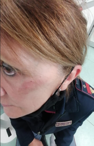 «Calci in faccia alla collega della Volante: violenza intollerabile verso chi fa il proprio dovere» «Calci in faccia alla collega della Volante: violenza intollerabile verso chi fa il proprio dovere»