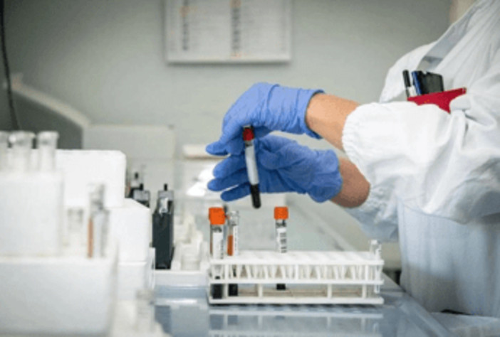 Alzheimer, test del sangue possono prevedere l'inizio dei sintomi