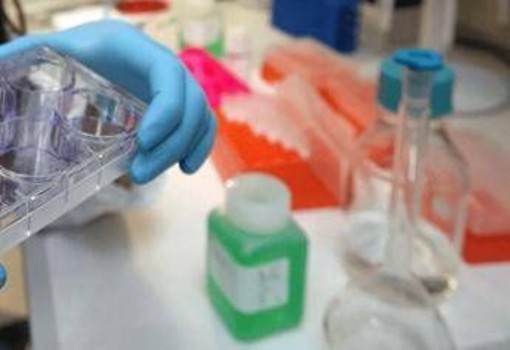 Cancro alla vescica, Berardi (Aiom): "Sangue nelle urine segnale da non sottovalutare" Cancro alla vescica, Berardi (Aiom): "Sangue nelle urine segnale da non sottovalutare"
