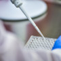 Idrosadenite suppurativa, alla Camera focus su Lea, Piano cronicità e innovazione terapeutica