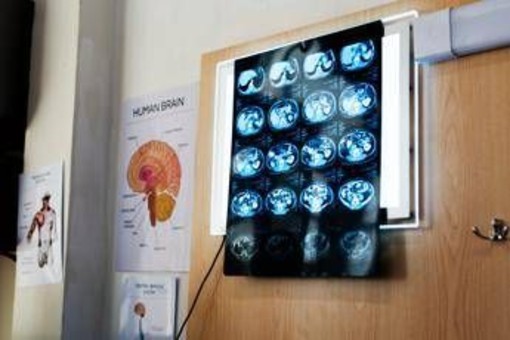"11 anni di chemio per un tumore che non c'era", la diagnosi sbagliata e l'incubo "11 anni di chemio per un tumore che non c'era", la diagnosi sbagliata e l'incubo