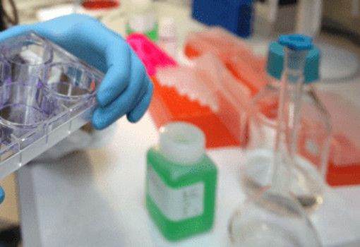 Tumori, al via studio per ridurre rischio recidive da cancro al seno