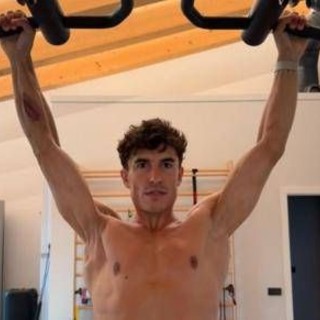 Marquez e la foto choc: il pilota mostra la spalla 'deformata'