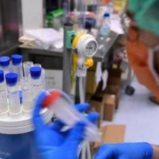 Legionella, il batterio che ama tubature e condizionatori: casi in aumento in Italia