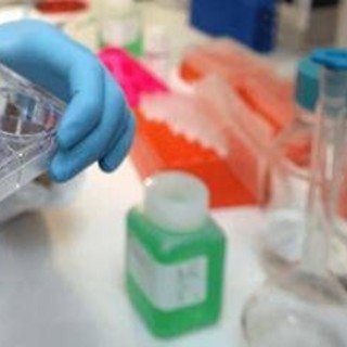 Cancro alla vescica, Berardi (Aiom): "Sangue nelle urine segnale da non sottovalutare" Cancro alla vescica, Berardi (Aiom): "Sangue nelle urine segnale da non sottovalutare"