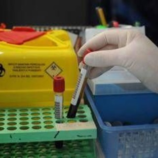 Tumori, nuovo test del sangue 'low cost' promette di scoprire diversi tipi di cancro