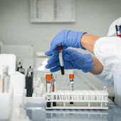 Cancro al pancreas, un nuovo farmaco raddoppia il periodo di sopravvivenza: lo studio Cancro al pancreas, un nuovo farmaco raddoppia il periodo di sopravvivenza: lo studio