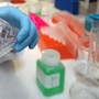 Tumori, al via studio per ridurre rischio recidive da cancro al seno Tumori, al via studio per ridurre rischio recidive da cancro al seno